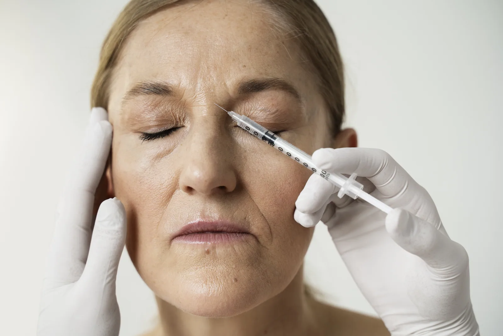 Bioestimulador de colágeno — tratamento estético na Santa Beleza, Moema